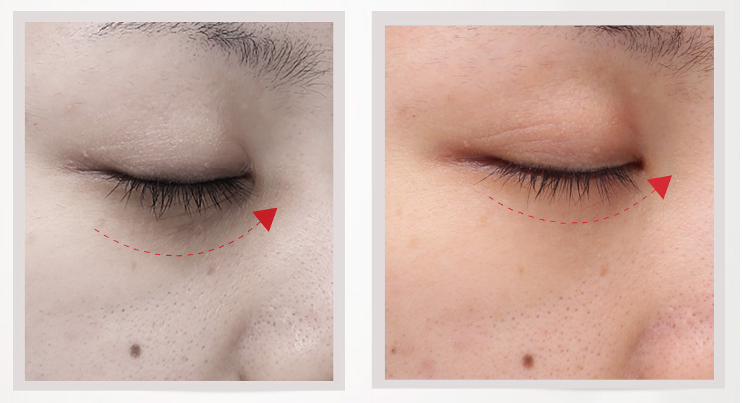 Xiaomi TOUCHBeauty Multifunction Eye Care Beauty Device